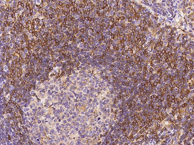 ABI3 Antibody - Immunochemical staining of human ABI3 in human lymph node with rabbit polyclonal antibody at 1:100 dilution, formalin-fixed paraffin embedded sections.