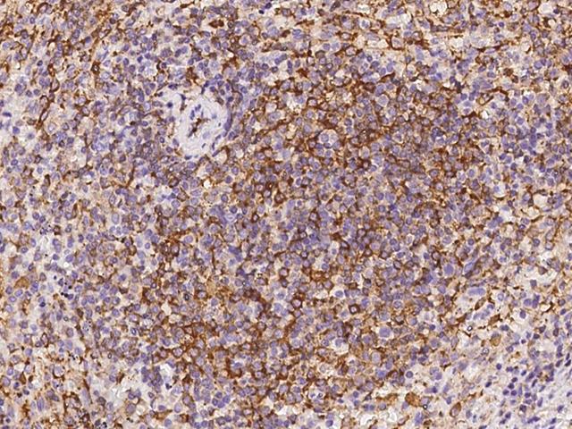 ABI3 Antibody - Immunochemical staining of human ABI3 in human spleen with rabbit polyclonal antibody at 1:100 dilution, formalin-fixed paraffin embedded sections.
