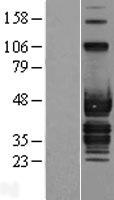 ABI3 Protein - Western validation with an anti-DDK antibody * L: Control HEK293 lysate R: Over-expression lysate