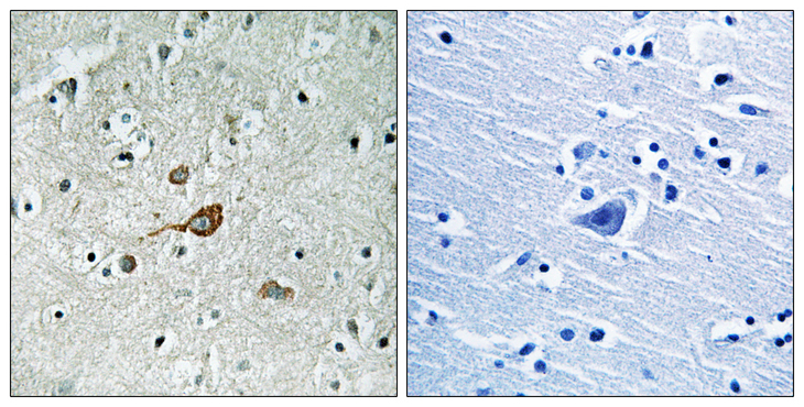ABL Antibody - Immunohistochemistry analysis of paraffin-embedded human brain tissue, using c-Abl Antibody. The picture on the right is blocked with the synthesized peptide.