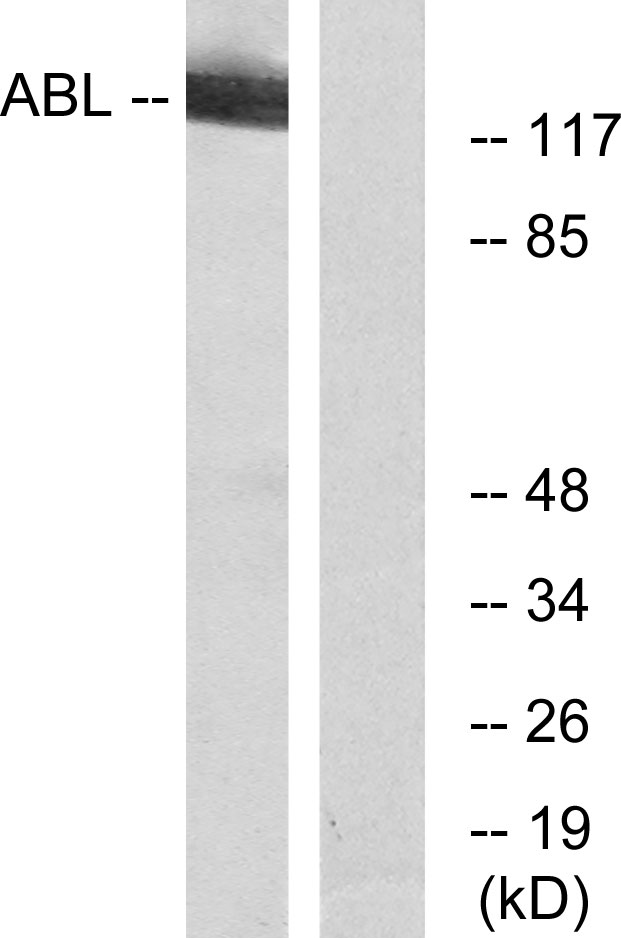 ABL Antibody - Western blot analysis of lysates from RAW264.7 cells, using c-Abl Antibody. The lane on the right is blocked with the synthesized peptide.