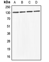 ABL Antibody - Western blot analysis of ABL1/2 expression in HeLa (A); HEK293T (B); Raw264.7 (C); PC12 (D) whole cell lysates.