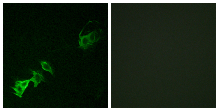 ABL Antibody - Immunofluorescence analysis of A549 cells, using Abl (Phospho-Tyr393/412) Antibody. The picture on the right is blocked with the phospho peptide.