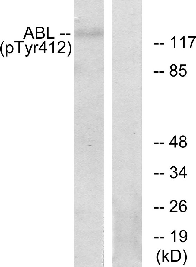 ABL Antibody - Western blot analysis of lysates from RAW264.7 cells, using Abl (Phospho-Tyr393/412) Antibody. The lane on the right is blocked with the phospho peptide.