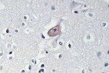 ABL Antibody - IHC of p-Abl1/2 (Y393/439) pAb in paraffin-embedded human brain tissue.
