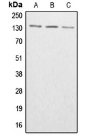 ABL Antibody - Western blot analysis of ABL1/2 (pY393/439) expression in HeLa colchicine-treated (A); SP2/0 colchicine-treated (B); H9C2 colchicine-treated (C) whole cell lysates.