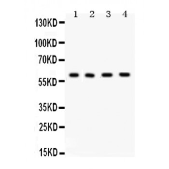 ABL1 / c-ABL Antibody - cABI antibody Western blot. All lanes: Anti cABI at 0.5 ug/ml. Lane 1: Rat Liver Tissue Lysate at 50 ug. Lane 2: SMMC Whole Cell Lysate at 40 ug. Lane 3: HELA Whole Cell Lysate at 40 ug. Lane 4: PANC Whole Cell Lysate at 40 ug. Predicted band size: 55 kD. Observed band size: 60 kD.