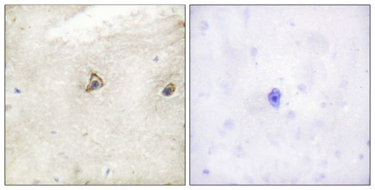 ABL1 / c-ABL Antibody - Immunohistochemistry analysis of paraffin-embedded human brain tissue, using c-Abl Antibody. The picture on the right is blocked with the synthesized peptide.