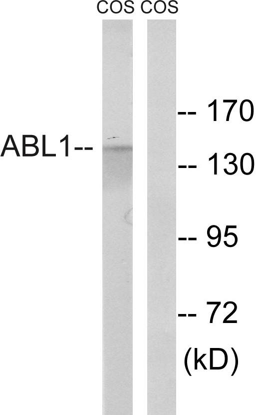 ABL1 / c-ABL Antibody - Western blot analysis of lysates from COS7 cells, treated with calyculinA 50ng/ml 30', using ABL1 Antibody. The lane on the right is blocked with the synthesized peptide.