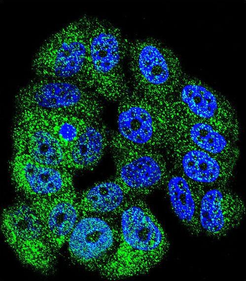 ABL1 / c-ABL Antibody - Confocal immunofluorescence of ABL1 Antibody with MCF-7 cell followed by Alexa Fluor 488-conjugated goat anti-rabbit lgG (green). DAPI was used to stain the cell nuclear (blue).