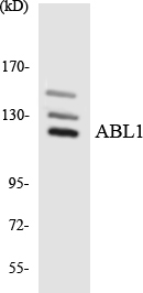 ABL1 / c-ABL Antibody - Western blot analysis of the lysates from HeLa cells using ABL1 antibody.