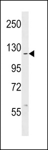 ABL1 / c-ABL Antibody - ABL1 Antibody western blot of MCF-7 cell line lysates (35 ug/lane). The ABL1 antibody detected the ABL1 protein (arrow).