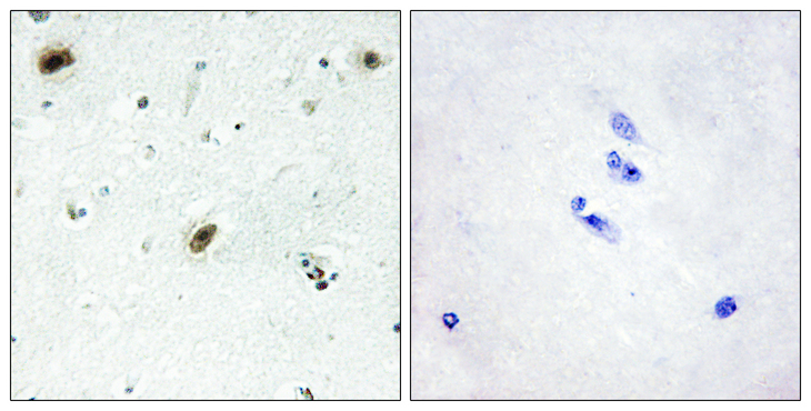 ABL1 / c-ABL Antibody - Immunohistochemistry analysis of paraffin-embedded human brain tissue, using ABL1 Antibody. The picture on the right is blocked with the synthesized peptide.