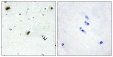 ABL1 / c-ABL Antibody - Immunohistochemistry analysis of paraffin-embedded human brain tissue, using ABL1 Antibody. The picture on the right is blocked with the synthesized peptide.