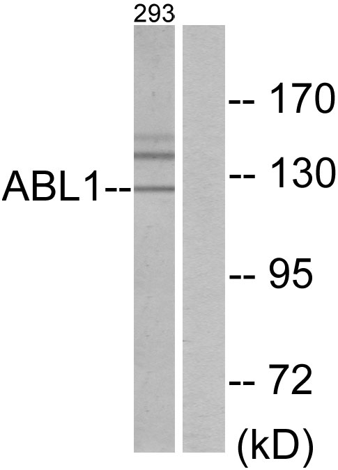 ABL1 / c-ABL Antibody - Western blot analysis of lysates from 293 cells, using ABL1 Antibody. The lane on the right is blocked with the synthesized peptide.