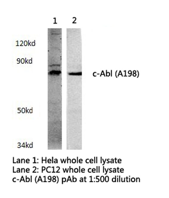 ABL1 / c-ABL Antibody - Western blot of c-Abl (A198) pAb in extracts from HeLa and PC12 cells.