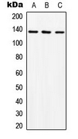 ABL1 / c-ABL Antibody - Western blot analysis of ABL1 expression in K562 (A); mouse liver (B); rat liver (C) whole cell lysates.