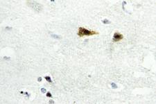 ABL1 / c-ABL Antibody - IHC of c-Abl (E883) pAb in paraffin-embedded human brain tissue.