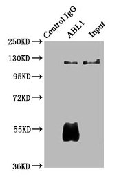 ABL1 / c-ABL Antibody - Immunoprecipitating ABL1 in Hela whole cell lysate Lane 1: Rabbit control IgG (1µg) instead of ABL1 Antibody in Hela whole cell lysate.For western blotting, a HRP-conjugated Protein G antibody was used as the secondary antibody (1/2000) Lane 2: ABL1 Antibody (6µg) + Hela whole cell lysate (500µg) Lane 3: Hela whole cell lysate (10µg)