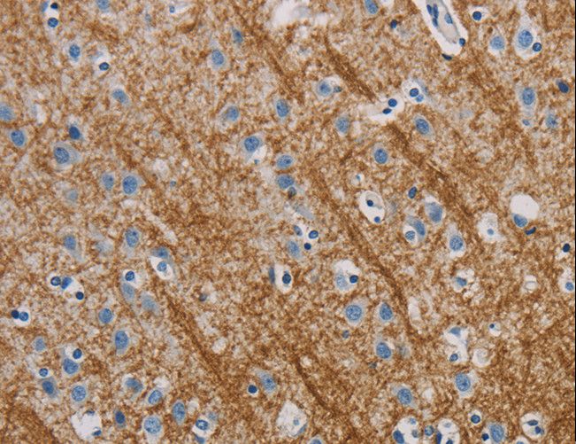 ABL1 / c-ABL Antibody - Immunohistochemistry of paraffin-embedded Human brain using ABL1 Polyclonal Antibody at dilution of 1:40.
