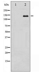ABL1 / c-ABL Antibody - Western blot of Abl expression in Adriamycin treated COS7 whole cell lysates,The lane on the left is treated with the antigen-specific peptide.