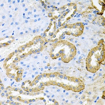 ABL1 / c-ABL Antibody - Immunohistochemical analysis of paraffin-embedded rat kidney tissue using Rabbit anti C-ABL antibody at a 1/100 dilution.
