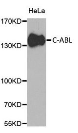 ABL1 / c-ABL Antibody - Western blot analysis of HeLa cell lysate using Rabbit anti C-ABL antibody at a 1/1000 dilution. 3% non-fat dry milk was used for blocking.