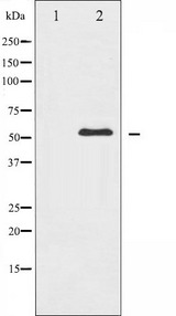 ABL1 / c-ABL Antibody - Western blot analysis of c-Abl expression in RAW264.7 whole cells lysates. The lane on the left is treated with the antigen-specific peptide.