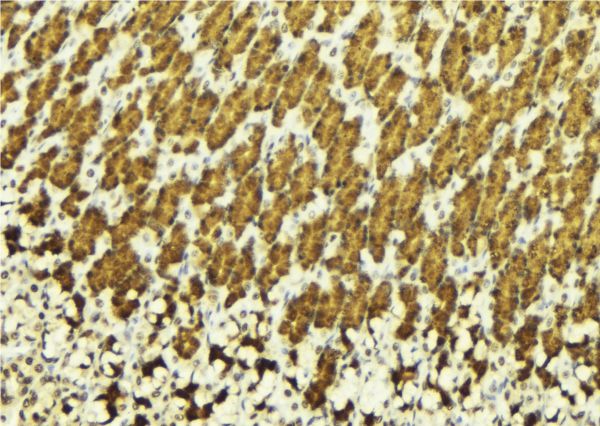 ABL1 / c-ABL Antibody - 1:100 staining human gastric tissue by IHC-P. The sample was formaldehyde fixed and a heat mediated antigen retrieval step in citrate buffer was performed. The sample was then blocked and incubated with the antibody for 1.5 hours at 22°C. An HRP conjugated goat anti-rabbit antibody was used as the secondary.