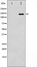 ABL1 / c-ABL Antibody - Western blot analysis of Abl expression in Adriamycin treated COS7 whole cells lysates. The lane on the left is treated with the antigen-specific peptide.