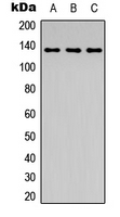 ABL1 / c-ABL Antibody - Western blot analysis of ABL1 (pY204) expression in HeLa colchicine-treated (A); mouse kidney (B); PC12 colchicine-treated (C) whole cell lysates.