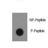 ABL1 / c-ABL Antibody - Dot blot of anti-Phospho-ABL1-Y134 Antibody on nitrocellulose membrane. 50ng of Phospho-peptide or Non Phospho-peptide per dot were adsorbed. Antibody working concentrations are 0.5ug per ml.