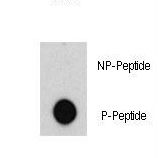 ABL1 / c-ABL Antibody - Dot blot of anti-ABL-pY185 antibody (RB07973) on nitrocellulose membrane. 50ng of Phospho-peptide or Non Phospho-peptide per dot were adsorbed. Antibody working concentrations are 0.5ug per ml.