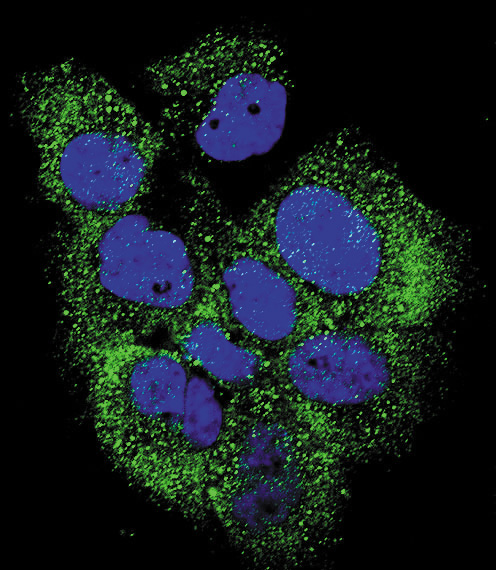 ABL1 / c-ABL Antibody - Confocal immunofluorescence of Phospho-ABL-Y185 Antibody with MCF-7 cell followed by Alexa Fluor 488-conjugated goat anti-rabbit lgG (green). DAPI was used to stain the cell nuclear (blue).