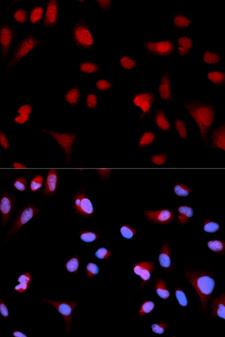 ABL1 / c-ABL Antibody - Immunofluorescence analysis of MCF7 cells.