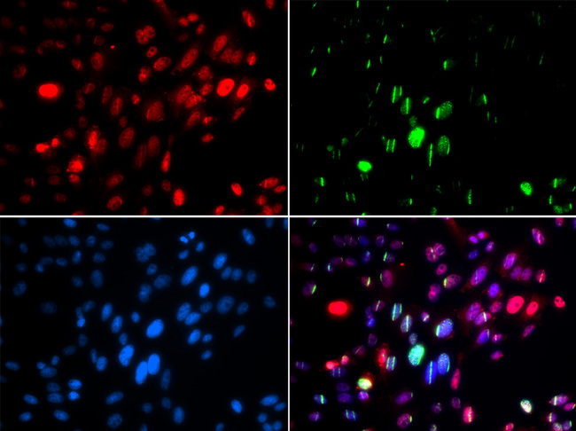 ABL1 / c-ABL Antibody - Immunofluorescence analysis of GFP-RNF168 trangenic U2OS cells.