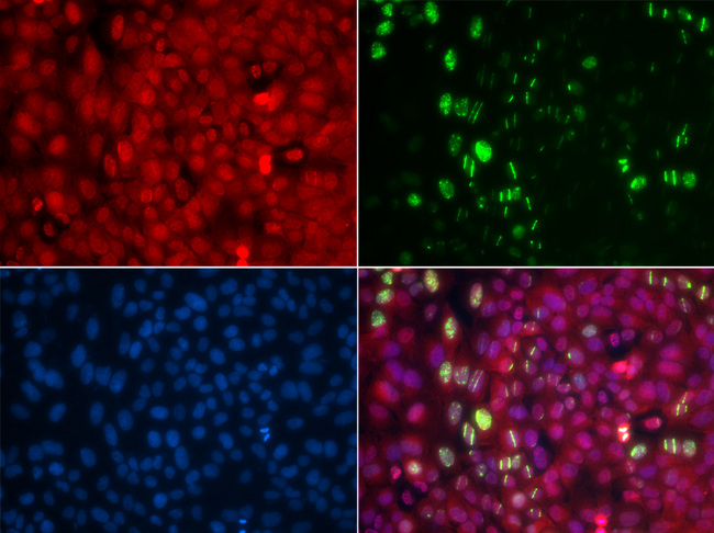 ABL1 / c-ABL Antibody - Immunofluorescence analysis of GFP-RNF168 trangenic U2OS cells.