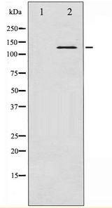 ABL1 / c-ABL Antibody - Western blot of Abl phosphorylation expression in Adriamycin treated COS7 whole cell lysates,The lane on the left is treated with the antigen-specific peptide.