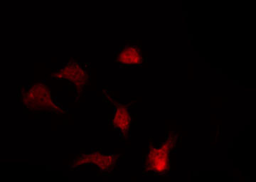ABL1 / c-ABL Antibody - Staining COS7 cells by IF/ICC. The samples were fixed with PFA and permeabilized in 0.1% Triton X-100, then blocked in 10% serum for 45 min at 25°C. The primary antibody was diluted at 1:200 and incubated with the sample for 1 hour at 37°C. An Alexa Fluor 594 conjugated goat anti-rabbit IgG (H+L) Ab, diluted at 1/600, was used as the secondary antibody.