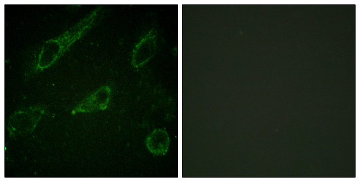 ABL1 / c-ABL Antibody - Immunofluorescence analysis of HeLa cells, using c-Abl (Phospho-Tyr245) Antibody. The picture on the right is blocked with the phospho peptide.