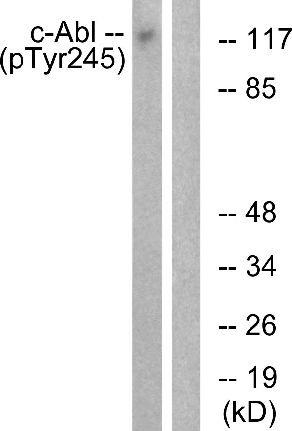 ABL1 / c-ABL Antibody - Western blot analysis of lysates from K562 cells treated with Insulin 0.01U/ml 15, using c-Abl (Phospho-Tyr245) Antibody. The lane on the right is blocked with the phospho peptide.
