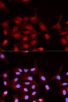 ABL1 / c-ABL Antibody - Immunofluorescence analysis of MCF7 cells.