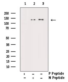 ABL1 / c-ABL Antibody - Western blot analysis of Phospho-c-Abl (Tyr245) antibody expression in Insulin treated K562 cells lysates. The lane on the right is treated with the antigen-specific peptide.