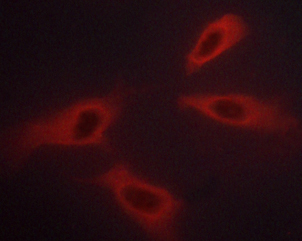 ABL1 / c-ABL Antibody - Staining K562 cells by IF/ICC. The samples were fixed with PFA and permeabilized in 0.1% saponin prior to blocking in 10% serum for 45 min at 37°C. The primary antibody was diluted 1/400 and incubated with the sample for 1 hour at 37°C. A Alexa Fluor® 594 conjugated goat polyclonal to rabbit IgG (H+L), diluted 1/600 was used as secondary antibody.