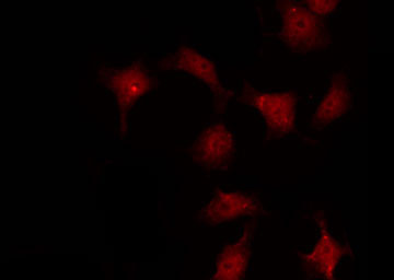 ABL1 / c-ABL Antibody - Staining COS7 cells by IF/ICC. The samples were fixed with PFA and permeabilized in 0.1% Triton X-100, then blocked in 10% serum for 45 min at 25°C. The primary antibody was diluted at 1:200 and incubated with the sample for 1 hour at 37°C. An Alexa Fluor 594 conjugated goat anti-rabbit IgG (H+L) Ab, diluted at 1/600, was used as the secondary antibody.