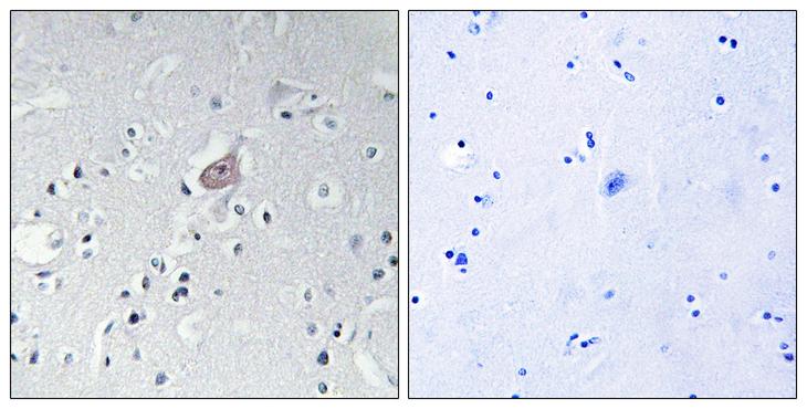 ABL1 / c-ABL Antibody - P-peptide - + Immunohistochemistry analysis of paraffin-embedded human brain tissue using Abl (Phospho-Tyr393/412) antibody.