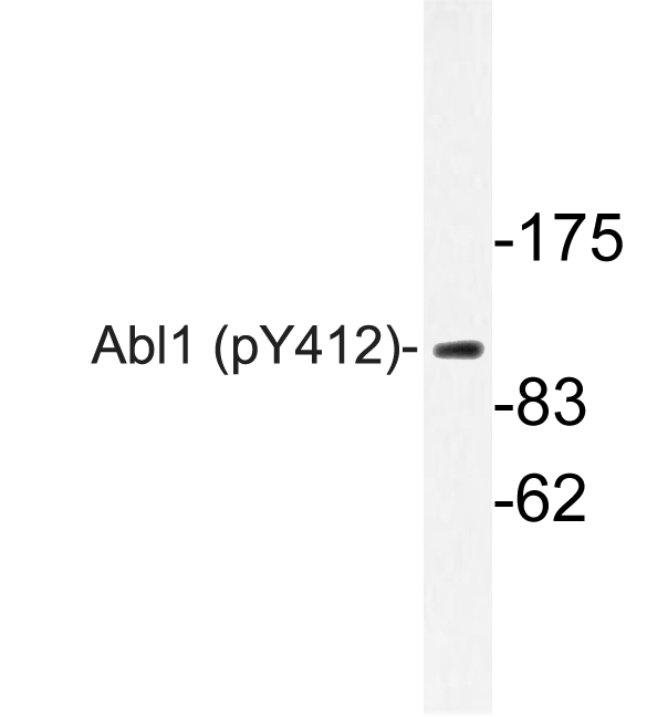 ABL1 / c-ABL Antibody - Western blot of p-Abl1 (Y412) pAb in extracts from COS7 Adriamycin cells.