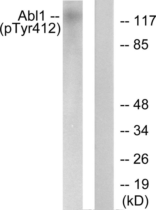 ABL1 / c-ABL Antibody - Western blot analysis of lysates from COS7 cells treated with Adriamycin 0.5ug/ml 24h, using Abl (Phospho-Tyr412) Antibody. The lane on the right is blocked with the phospho peptide.