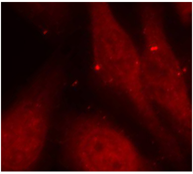 ABL1 / c-ABL Antibody - Immunofluorescence staining of methanol-fixed HeLa cells.
