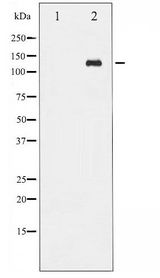 ABL1 / c-ABL Antibody - Western blot of Abl phosphorylation expression in Adriamycin treated COS7 whole cell lysates,The lane on the left is treated with the antigen-specific peptide.